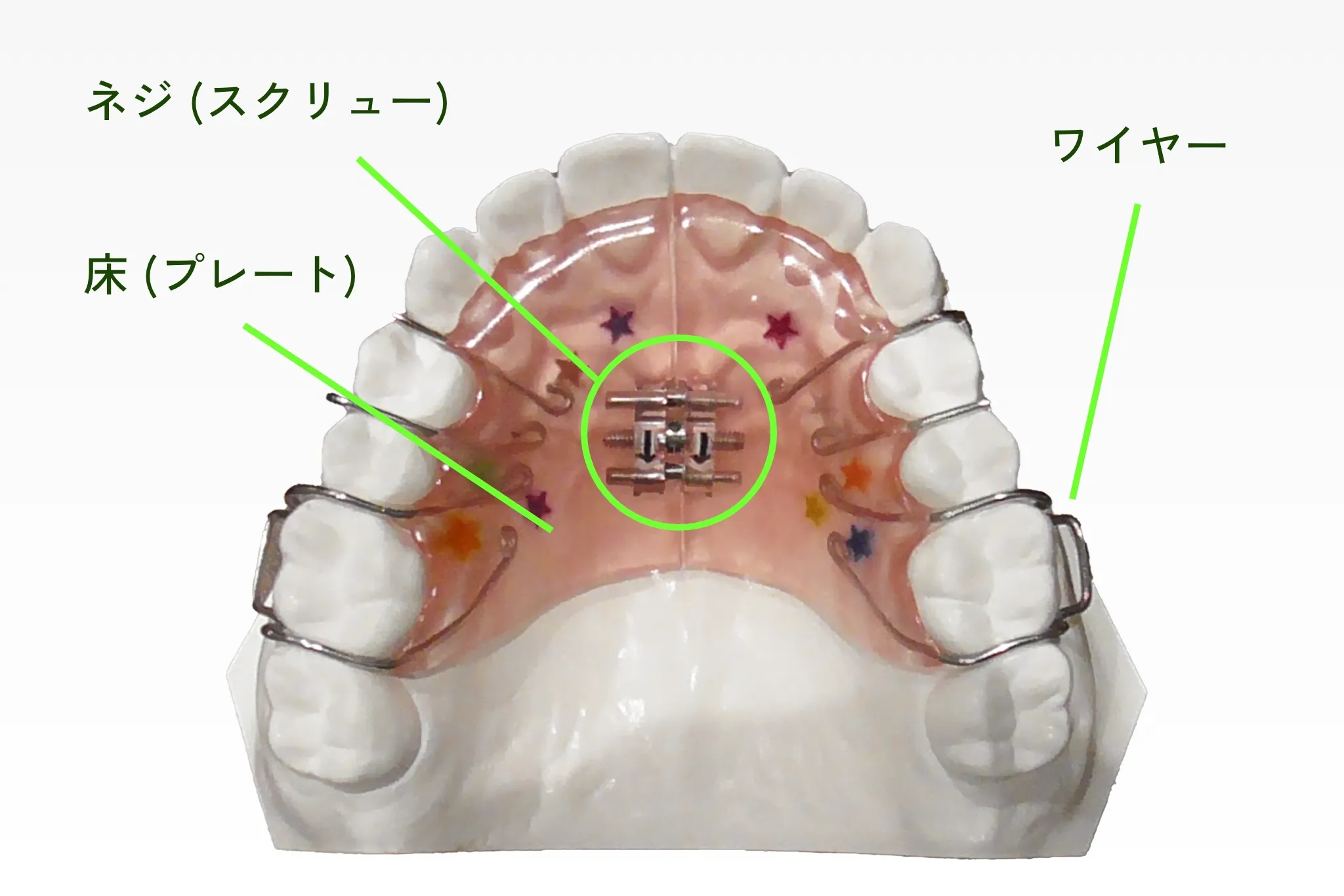 床矯正の仕組み