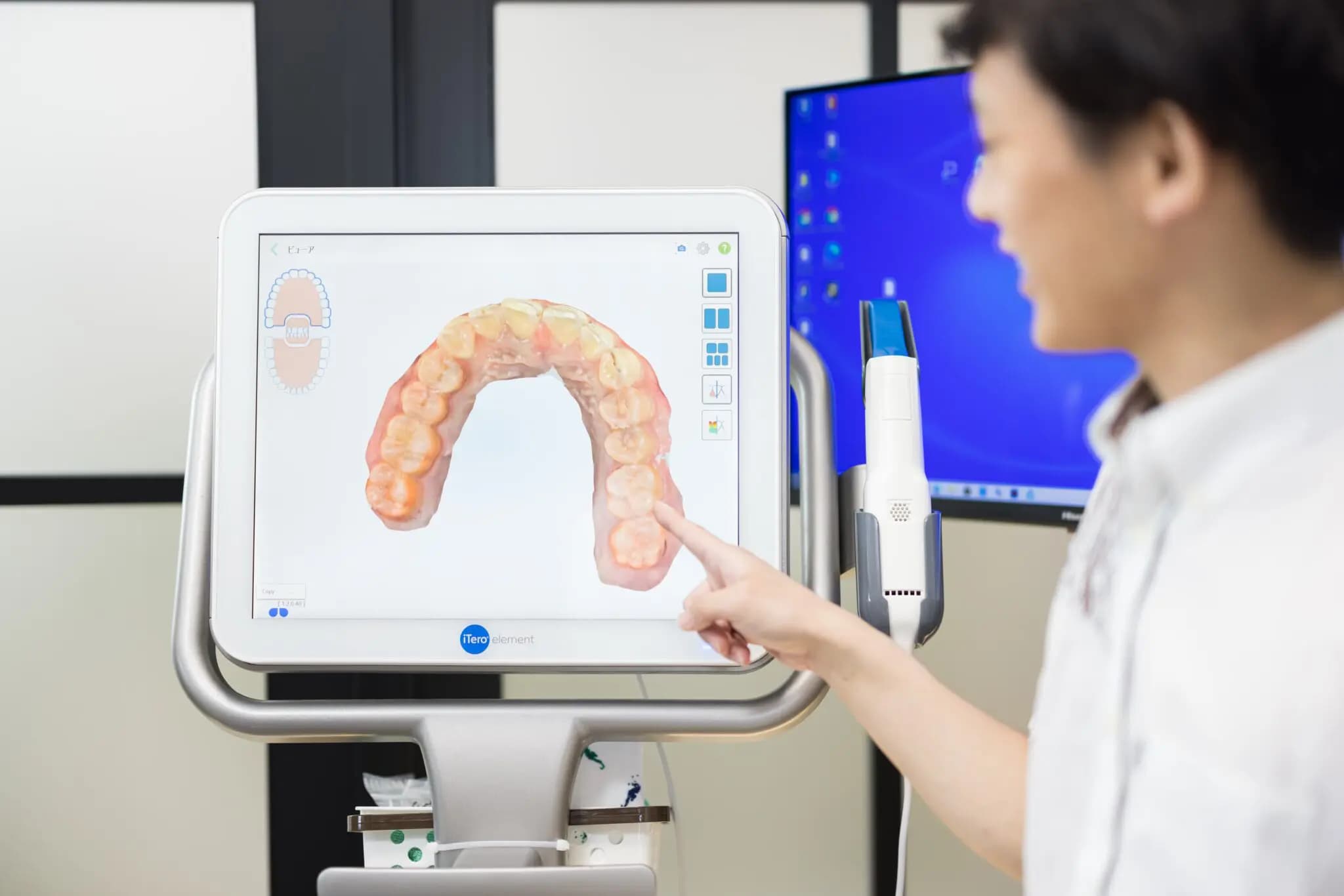 マウスピース型矯正歯科装置（インビザライン）の特徴